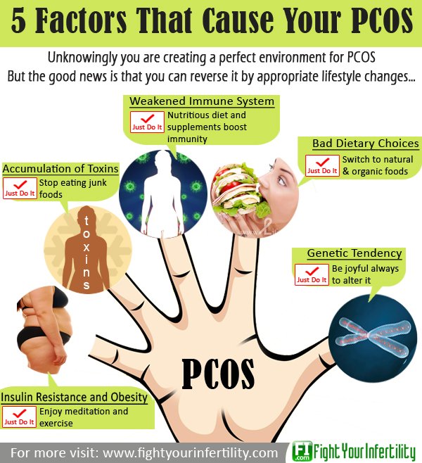 Polycystic Ovary Syndrome (PCOS) - Treatment Overview